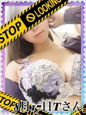 【お礼】掻いちゃ(｀･д･)σ メッ!!8月17日Tさん